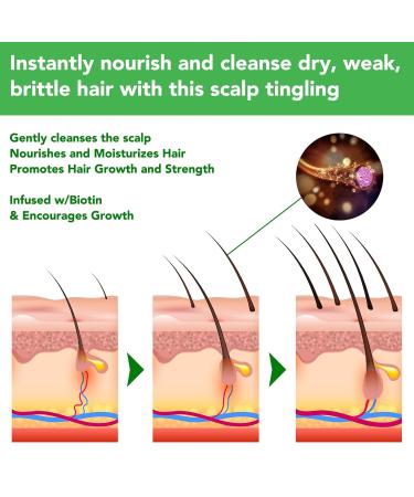 Biotin Rosemary Shampoo for Thinning Hair - Strengthening Rosemary Mint Formula 10.56 oz / 300 ml - Effective Hair Loss Care - Buy Online on GoSupps.com