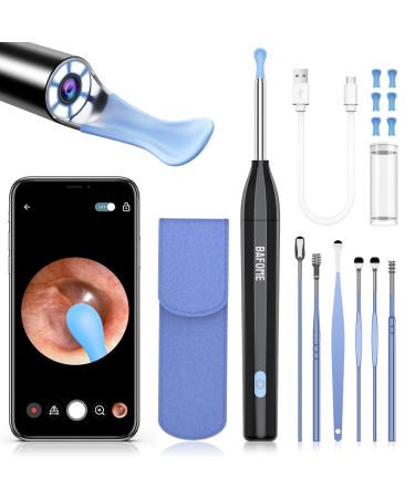 Ear Wax Removal Tool Kit Earwax Removal Kit Ear Cleaning Tool with 6 Ear Set and 6 Ear Pick 1920P Ear Cleaner with Camera and Light Ear Camera and Wax Remover for iPhone Ipad & Android Dark Black