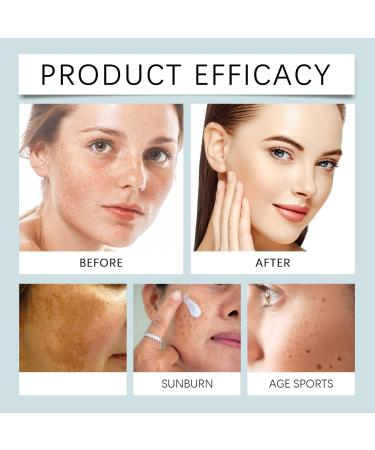 Orgrul 2025 New cream against pigment spots pigment spots for face age spots cream with retinol and hyaluronic acid serum against melasma spots - Buy Online on GoSupps.com