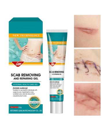 G n rique Scar Cream | Soothing 20g - Advanced Repair Cream For Scars For Comfort Recovery Burn Protection Domestic Body Injury