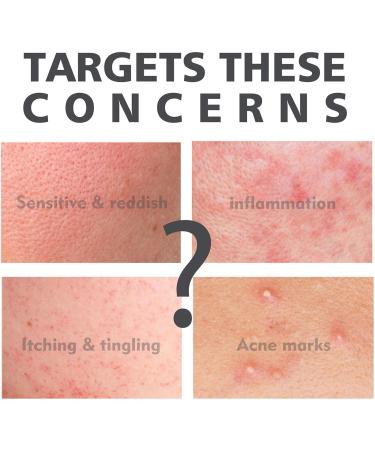 Salicylic Acid Serum 30ml - Face Exfoliator - Hyaluronic Acid Serum - Skincare Face Oil - Dark Spot Correcting Glow Serum - BHA Exfoliant - Hydrating Serum for Face Peeling Moisturising and Soothing - Buy Online on GoSupps.com