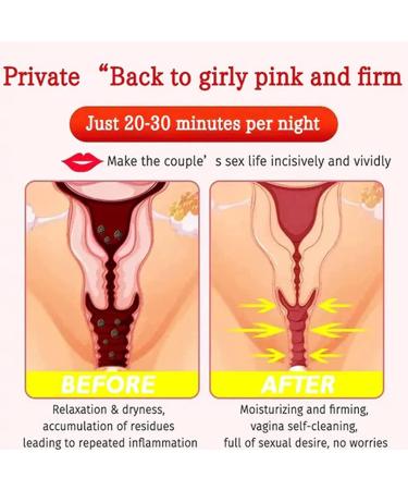 Annie Care Instant Anti-Itch Detox Slimming Gel - Natural Viginal Detox (3 Pack) - Buy Online on GoSupps.com