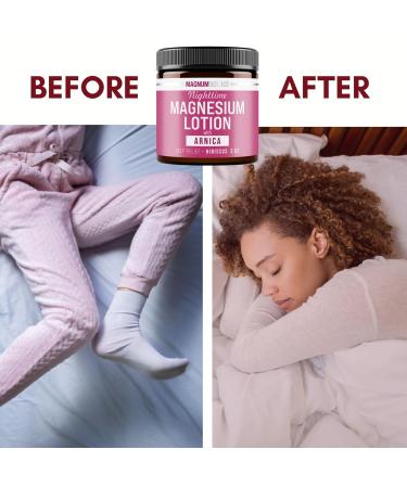 Magnum Solace Nighttime Magnesium Lotion with Arnica Soothing Relief & Relaxation Highly Concentrated Magnesium for Muscles & Joints Apply to Legs or Feet Before Bed Skin-Friendly - Buy Online on GoSupps.com