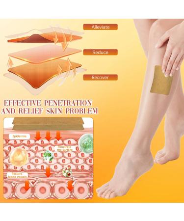 Wanban 48 PCS Turmeric Varicose Vein Patch Natural Relief Treatment for Legs Spider Varicose Vein Patch - Buy Online on GoSupps.com