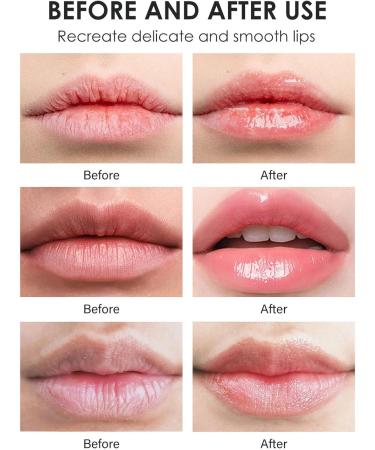 Turmeric Exfoliating Lip Scrub for Dark Lips Organic Exfoliating Balm for Dry Chapped Lips Gentle Exfoliating Moisturizer for Nourishing and Smoothing Lips - Buy Online on GoSupps.com