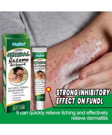  MagiSel Eczema Skin Care Cream 20g Anti Itch Cream Improves Dry Skin - Buy Online on GoSupps.com
