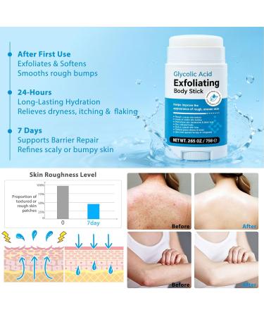 Glycolic Acid Exfoliating Body Stick Exfoliating Body Cream Gently Exfoliates Improve the Appearance of Rough Uneven Skin & Softens Skin BodyCare Stick for Underarms Strawberry Legs Bodys 2.65oz - Buy Online on GoSupps.com