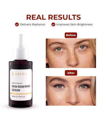 ABERA Saffron Serum For Melasma Treatment Renewing for Face Anti-Aging Treatment for Fine Lines & Wrinkles High Potency Saffron Extract Hydrating Serum Dark Spot Remover (2 BOXES) 1.01 Fl Oz (Pack of 2) - Buy Online on GoSupps.com