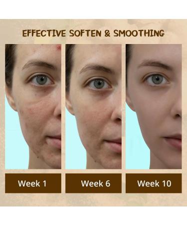  Ceboic Turmeric Soap Bars Natural Kojic Acid Soap for Face and Body Anti-Blackhead for Even Skin Tone Moisturizing Fine Lines Era - Buy Online on GoSupps.com