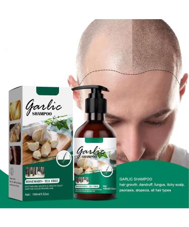 ANCHORAGE Garlic Shampoo 100ml AntiHair Loss Shampoo with Organic Oil Men Plant Extract Itch Relief Dandruff Removal Hair Loss Treatment - Buy Online on GoSupps.com