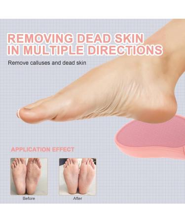 Foot Grinder Hand Tools Scraper Tool Scraper File Pedicure Remover Pedicure Files Foot File Removers for Feet Foot Scrubber Dead Skin Remover for Feet Plastic SKISUNO - Buy Online on GoSupps.com