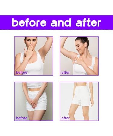 Mnozreo Lightening cream for the body 60 g 1 piece whitening cream for the intimate area armpits elbows - Buy Online on GoSupps.com
