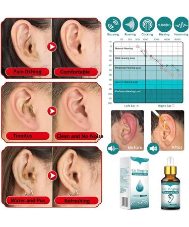 YOOUS Ear Ringing Treatment Oil - All Natural Herbal Remedy Drops for Ear Ringing Relief - 2pcs - Buy Online on GoSupps.com