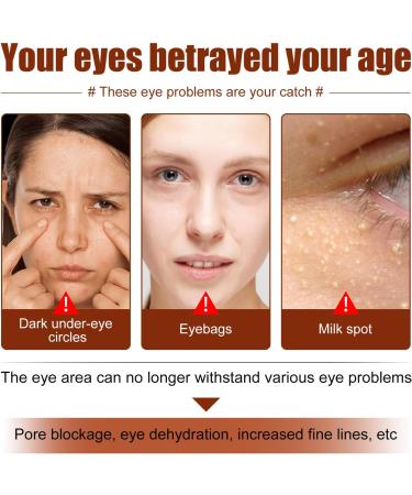 KOAHDE Milia Spot Remover Eye Creams Dark Circles Remover Lightens Cream Moisturizing Milia Eyes Cream Eye Creams Ruduce Milia Milia Removal Eye Creams Speedy Milia Remover Eye Cream 1PC - Buy Online on GoSupps.com