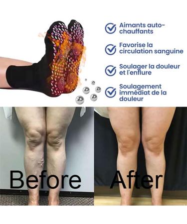 Alvo Feet Socks - Varicose Veins Acupressure Self-Heating Shaping Socks (3 Pairs Black) - Buy Online on GoSupps.com