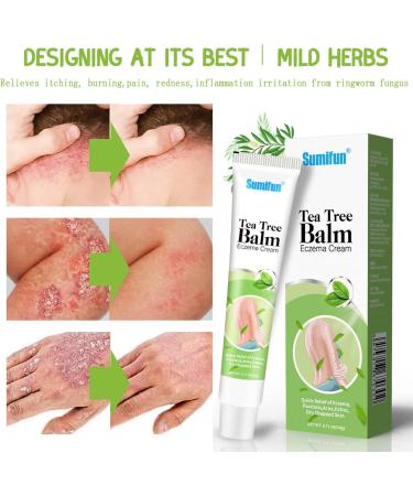 Tea Tree Oil Anti-Itch Cream for Psoriasis & Eczema - Natural Herbal Ingredients, Sensitive Skin Soothing Moisturizer (0.7oz x 10) - Buy Online on GoSupps.com