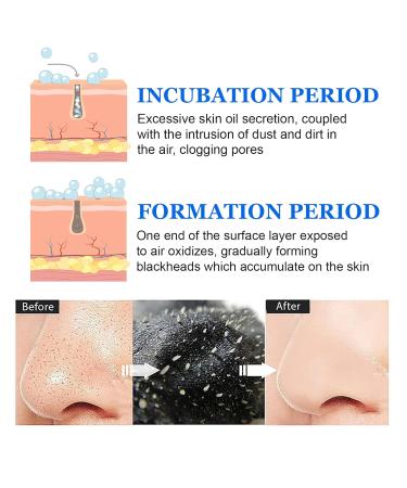 Tiuedu Blackhead Pore Strips - 70PCS Charcoal Nose Strips for Deep Cleansing & Instant Blackhead Removal | Natural Pore Cleaner for Men - Buy Online on GoSupps.com