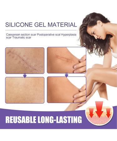 Silicone Scar Sheets - Surgical and Caesarean Scar Removal Tape for Men and Women - Buy Online on GoSupps.com