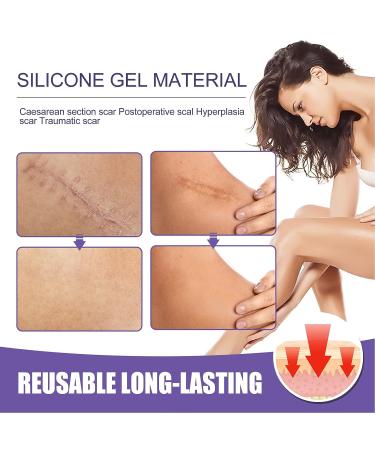 Silicone Scar Sheets - Breathable Scar Reducer for Men and Women - Scar Removal Strips for Concealing and Reducing Scars - Buy Online on GoSupps.com