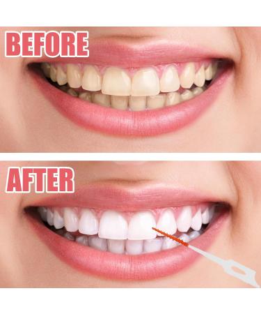 320 pcs Soft Silicone Interdental Brushes with Box | Dual-House Dental Floss Sticks for Effective Tooth Cleaning - Buy Online on GoSupps.com