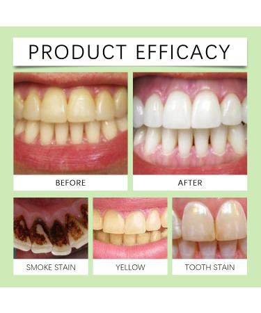 KLYso Green Tea Whitening Toothpaste - Gentle Cleaning Stain Removal & Enamel Protection for Sparkling Teeth(3PCS) - Buy Online on GoSupps.com