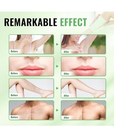 Wax Strips for Body Hair Removal | 120 Strips + 8 Oil Wipes | Dual Sided Bikini & Brazilian Wax Kit for Men & Women - Odourless & Skin-Friendly - Buy Online on GoSupps.com