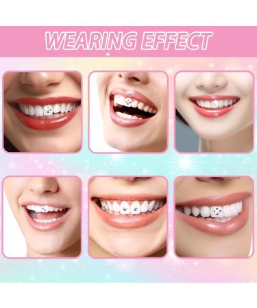 Premium Tooth Jewelry Kit - Complete Tooth Gem Set with Glue | Enhance Your Smile with Tartar Jewelry - Buy Online on GoSupps.com