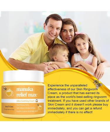 Manuka Honey Cream for Eczema, Psoriasis, Tinea Versicolor & More - 4 fl oz | Fast Acting Relief for Skin Conditions | Adults & Kids - Buy Online on GoSupps.com