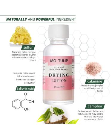 Acne Drying Lotion | Overnight Acne Treatment for Pimples & Blemishes | Fast Spot Treatment (1OZ) - International Shipping - Buy Online on GoSupps.com