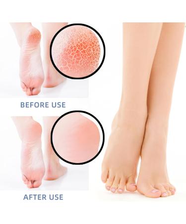 Silicone Heel Protectors for Cracked Heels - 8 Pack | Cushioned Inserts for Plantar Fasciitis Achilles Tendonitis & Blister Prevention | Moisturizing Callus Relief - Buy Online on GoSupps.com