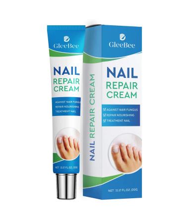 Fungal Nail Treatment Fungus Nail Cream Strong Anti-Fungal Toenail Cream Nail Repair Nourishing Treatment Restores Discolored and Damaged Nails