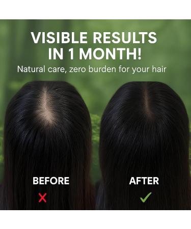 ZHONGHENGDIANZI Nature Triangle Shampoo Bar Nature Seven Green Soap Shampoo caring shampoo soap soothes and strengthens the hair for women and men 1 piece 1 piece - Buy Online on GoSupps.com