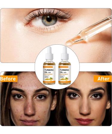 ieron 2pcs Natural Turmeric Oil Skin Care Fights Acne Heals Scars Turmeric Facial Serum Turmeric Serum for Dark Spots 10ml - Buy Online on GoSupps.com