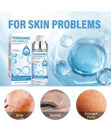 10% Tranexam c Acid Serum D scolorat on Correcting Serum Natural Spot Remover for Face with Hyaluronic Acid & Niacinamide 50 ML - Buy Online on GoSupps.com