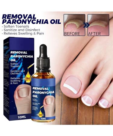 German Toenailcare Removal Paronychia Oil - Repair Damaged Discolored Thick Nails - 2 Pcs - Buy Online on GoSupps.com