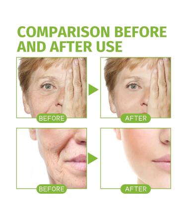 Deep Cleansing Facial Foam Mousse - Oil Control Wrinkle Reduction Hydrating Face Wash For Refreshing & Radiant Skin(2PCS) 1 Count (Pack of 1) - Buy Online on GoSupps.com