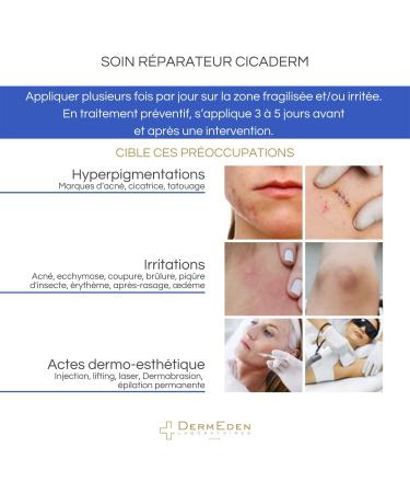 Laboratoires DermEden - Cicaderm Repair Treatment 30 ml - Alcohol and Fragrance Free - Repairs Damaged and Damaged Skin - Soothes Regenerates and Promotes Healing - Made in France - Buy Online on GoSupps.com