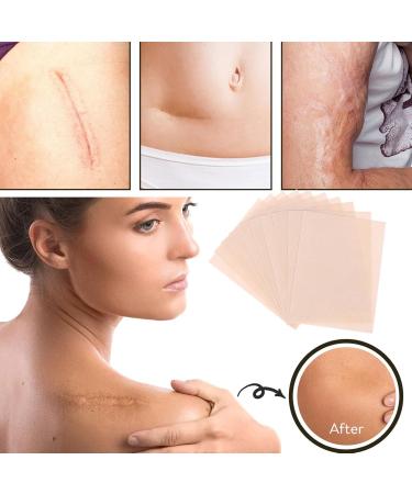 Skin Tone Concealer Stickers Scar Concealing Tape | Long Lasting Scar Concealing Tape Skin Invisible Concealer Sticker Invisible Flaw Conceal Sticker for Hide Skin Spots Light Beige - Buy Online on GoSupps.com