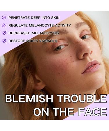 Dark Spot Remover for Face Spot Cream Dark Spot Corrector Skin Lightening Cream Pigmentation Removal Cream Dark Spot Correcting Glow Serum for Melasma Freckle Sun Spot Remover Blemish Reduction - Buy Online on GoSupps.com