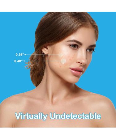 Hydrocolloid Pimple Patches for Face | 288 Acne & Blemish Repair | Ideal for Makeup & Skincare - Buy Online on GoSupps.com