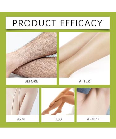  Generisch Generisch Cyperus Rotundus 100% Natural Rotundus Oil - Hair Removal for Body - Liquid - Hair Growth Reduction - For All Skin - Buy Online on GoSupps.com