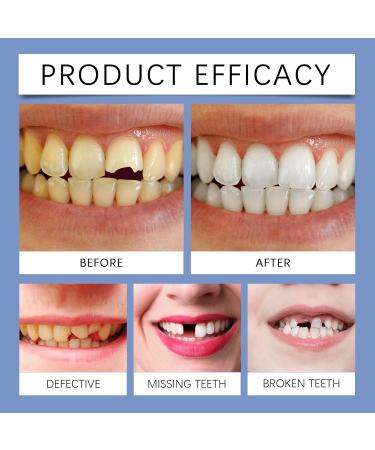 Blue LED Dental Curing Light with Moldable Denture Gel Professional Tooth Repair Kit Long-Lasting Polymer Material - Buy Online on GoSupps.com