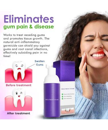 Lot de 3 boosters de blanchiment des dents mousse mousse ultra-fine 50 ml - Buy Online on GoSupps.com