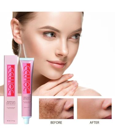 Dark Spot Corrector Serum for Face and Body - Brightening and Fading Cream - Buy Online on GoSupps.com