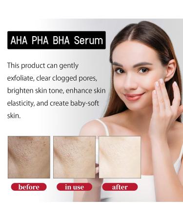 AHA BHA PHA 32% Liquid Exfoliant for Face High-Strength Multi-Acid Peel to Help Refine Skin Texture Enhance Radiance and Support a Smoother-Looking Complexion Suitable for All Skin Types 1 fl oz - Buy Online on GoSupps.com