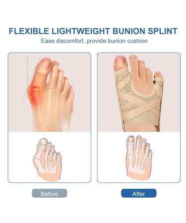 Plantarelief Hallux Valgus Corrector - Toe Correction Socks & Bandage for Great Toe Pain Relief - 1 Pair - Buy Online on GoSupps.com