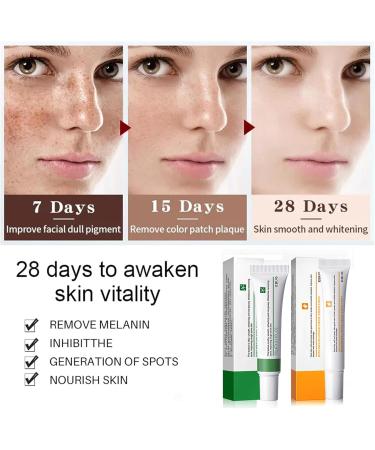 Anti Acne Face Cream Dark Spot Remover for Face Spot Cream for Acne Treatment and Spot Treatment Age Spot Remover for Face Rapid Action Spot Cream for Blackheads and Acne Prone Skin - Buy Online on GoSupps.com