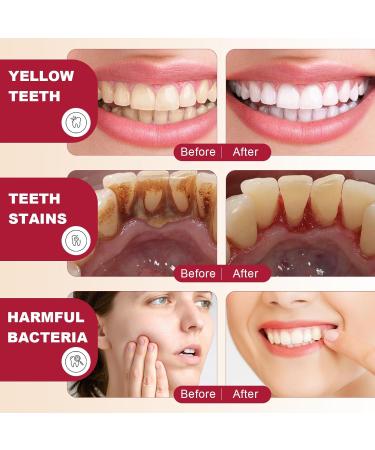 SP-6 Probiotics Ultra Whitening Toothpaste - Deep Cleaning & Fresh Breath 2PCS - Brighten Teeth & Remove Stains - Buy Online on GoSupps.com