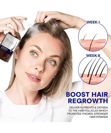 Blossoms Hair Growth Serum Spray - Densifique Formula for Fast Hair Growth with Ashwagandha - 2pcs - Buy Online on GoSupps.com