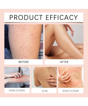 Tallow skin cream natural face and body care rich moisturizer with bovine tallow soothing and nourishing care for supple skin tallow cream - Buy Online on GoSupps.com